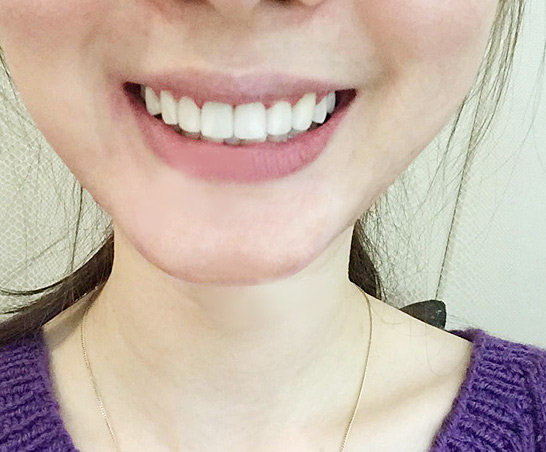 深圳正夫口腔连锁(股票代码:872051)