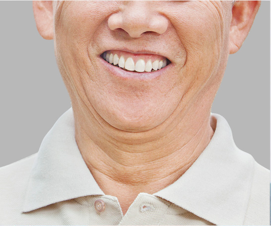 深圳正夫口腔连锁(股票代码:872051)