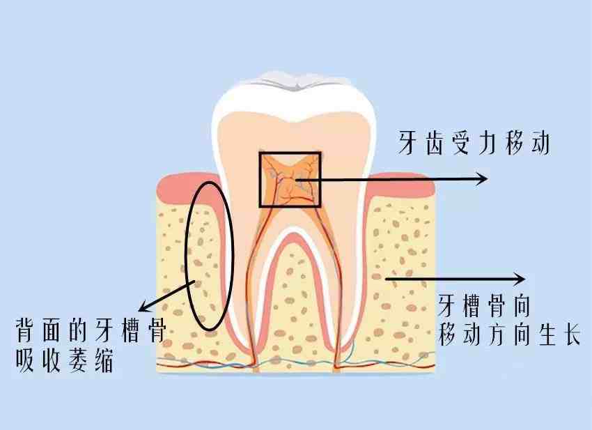 25岁了，牙齿矫正还有用吗?